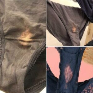 This is what it means if you find a “bleach” spot on your underwear