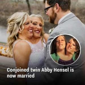 Conjoined Twin Abby Hensel Is Now Married !