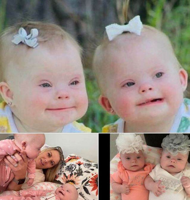 ‘Like one in 2 million’: Mom says rare twins with Down syndrome are ‘my little gems’