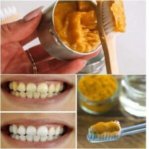 Discover How Turmeric Can Transform Your Life and Enhance Your Dental Health Naturally