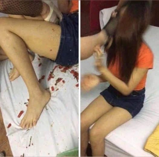 🛑Young woman d…. at the hands of her…