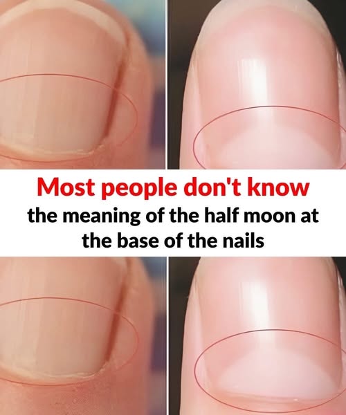 What does the half moon at the base of the nails mean?