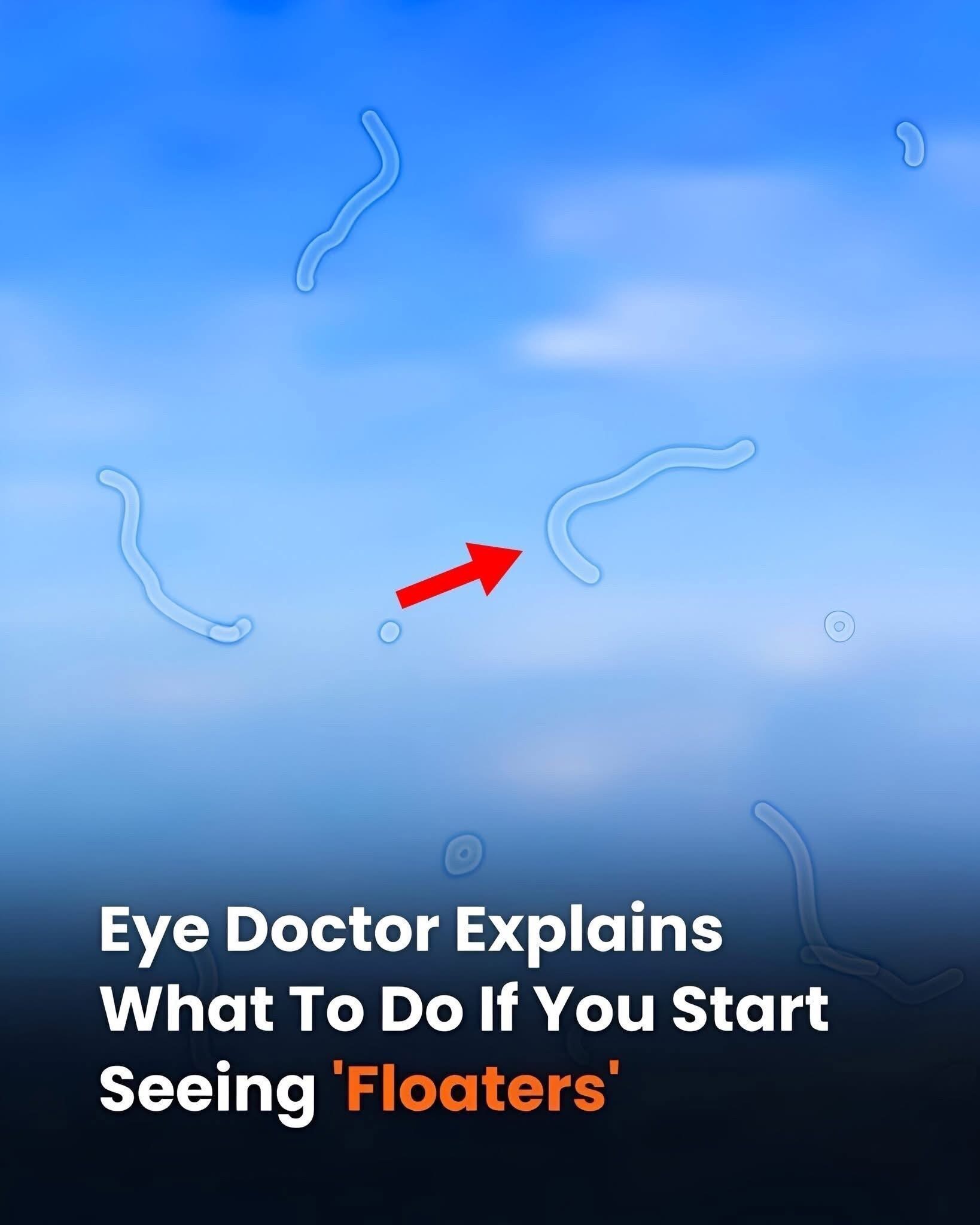 Eye Doctor Explains What To Do If You Start Seeing