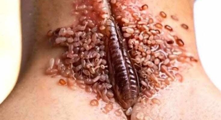 SKIN SIGNALS USED TO DIAGNOSE SERIOUS DISEASES