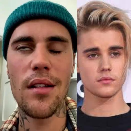 Justin Bieber admits that he tested positive for…
