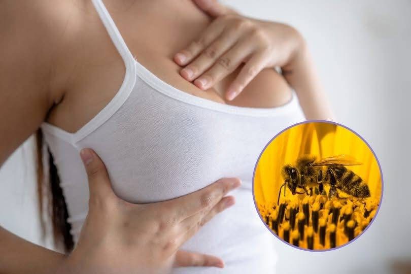 A Small Sting, A Giant Leap-Could This Be the Future of Cancer Treatment?