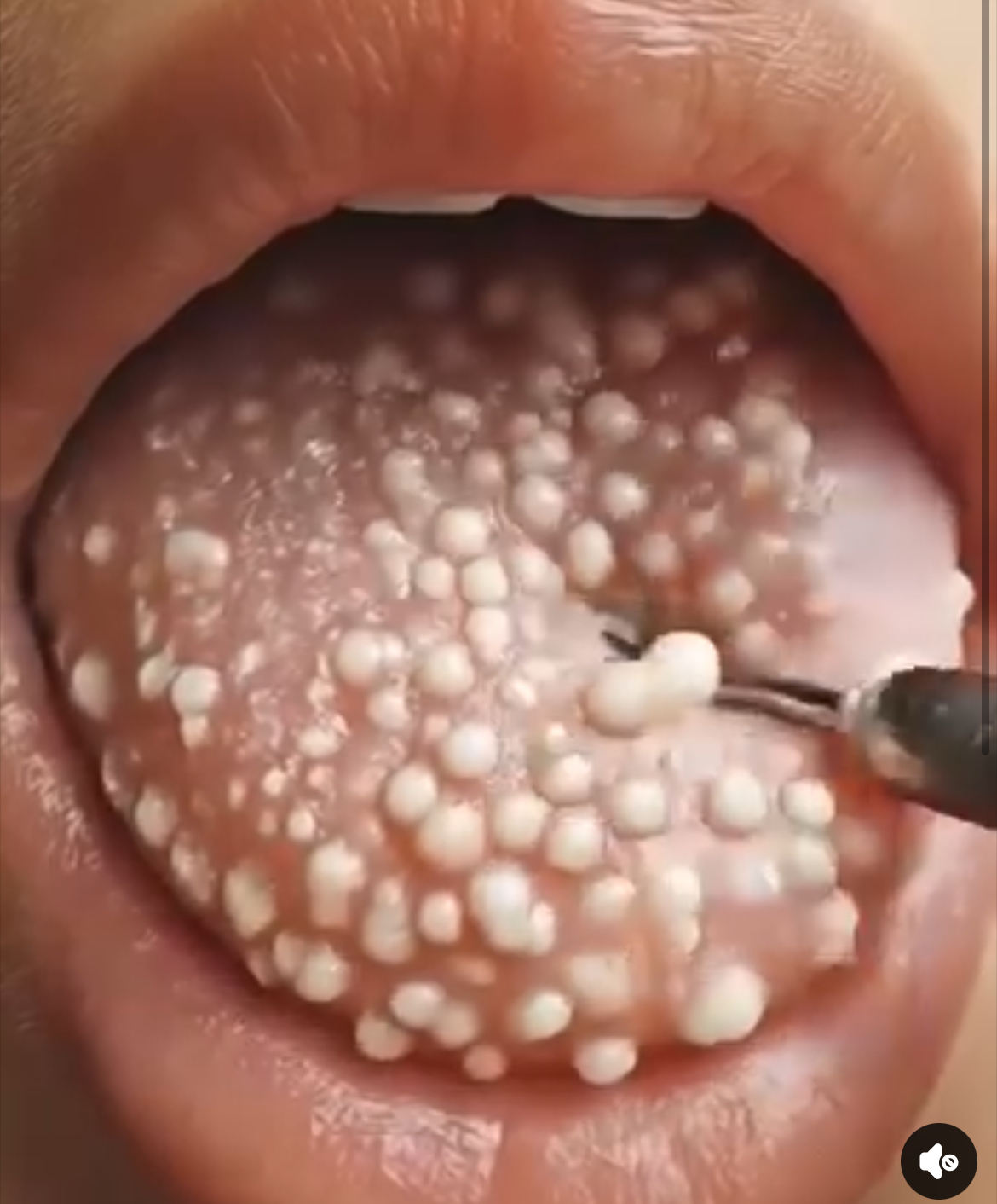 These are the consequences of sleeping with!!!