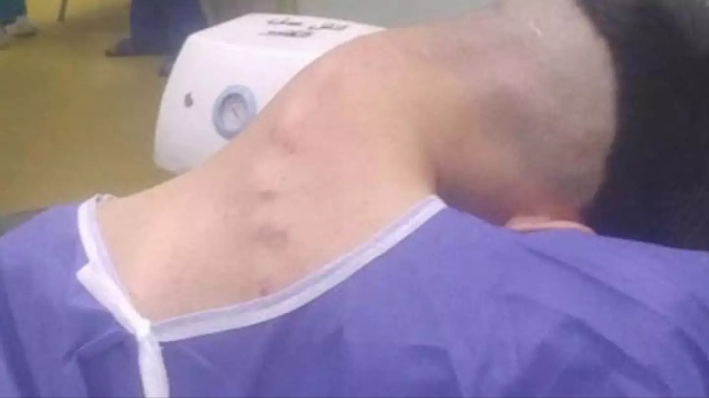 Young man hospitalized because he dropped his ca…See more