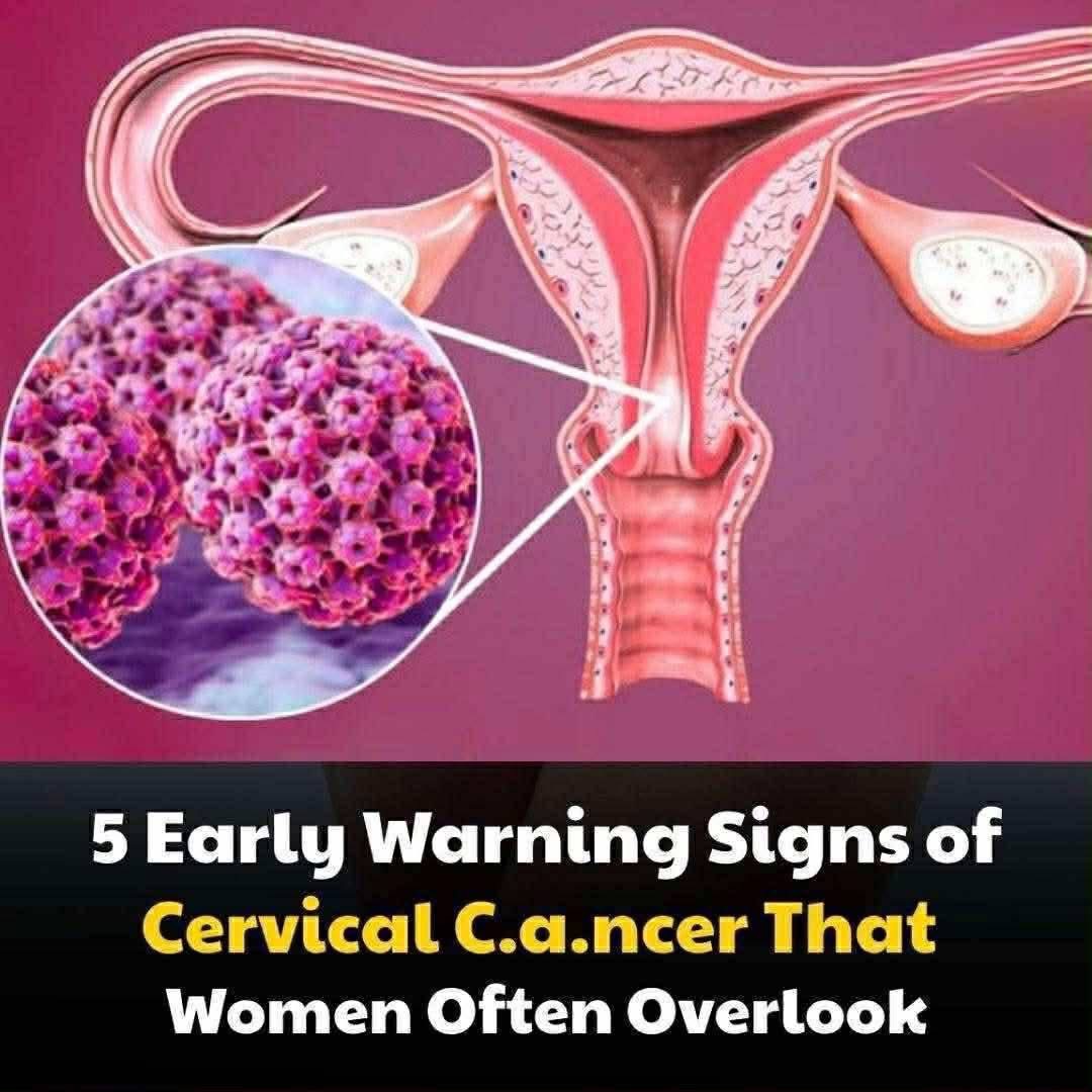 5 early warning signs of cervical cancer